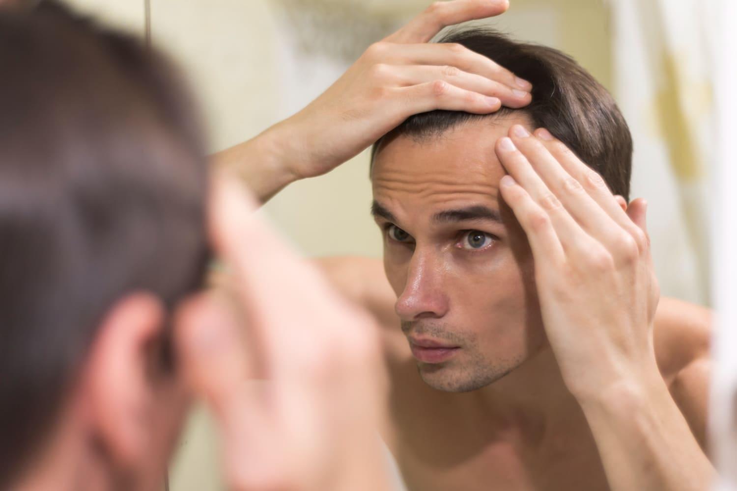 Man examining his hairline in the mirror while following hair transplant aftercare