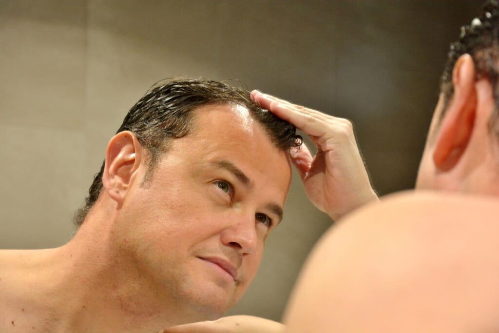 Man with wet hair checking his scalp during the first week of hair transplant recovery