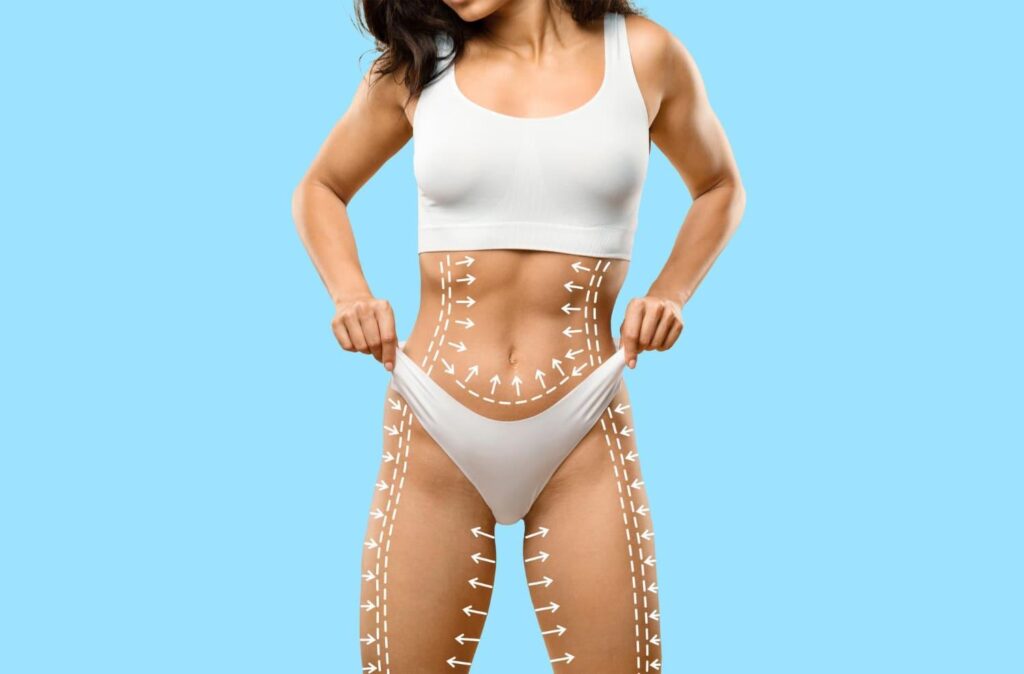 Body-contouring markings on a woman's abdomen, hips and thighs for a mummy makeover