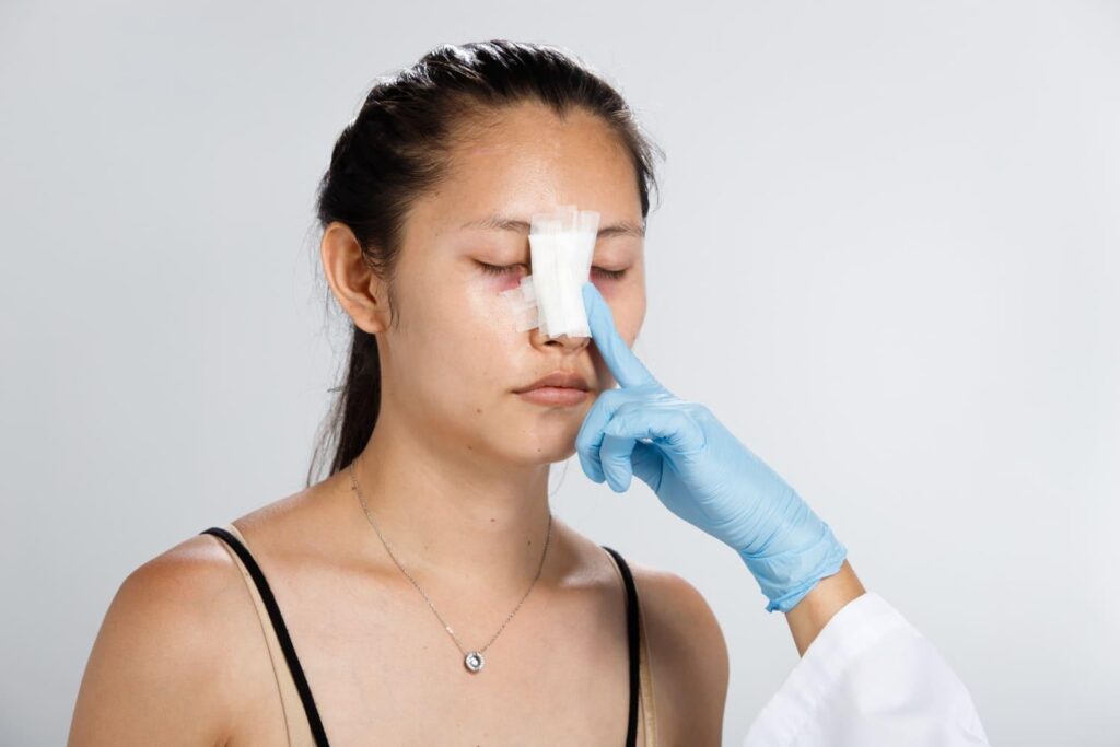 Woman wearing a nasal splint during rhinoplasty recovery as a surgeon checks healing