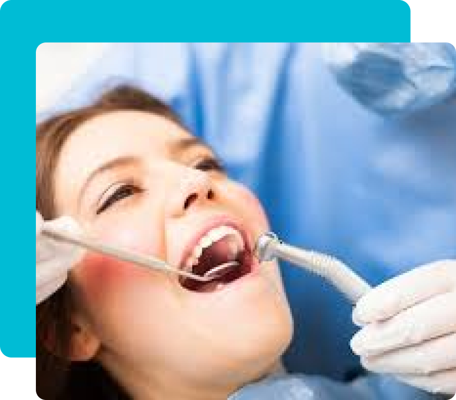 Group 5 27 Sinus Lift in Turkey