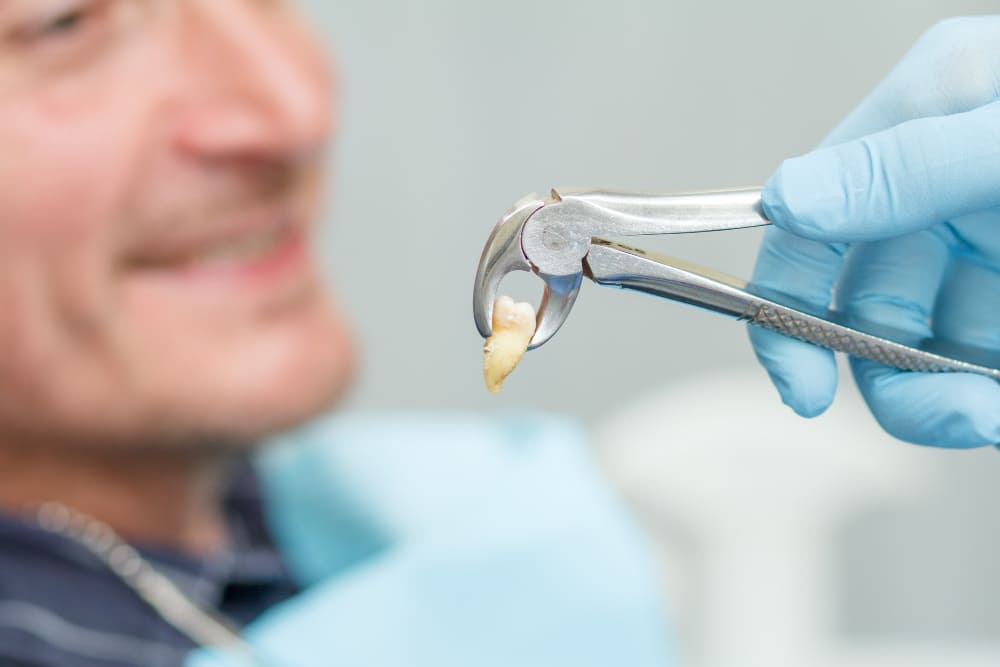 Ear Ache After Wisdom Tooth Extraction: Causes and Relief 28 Wisdom tooth extracted