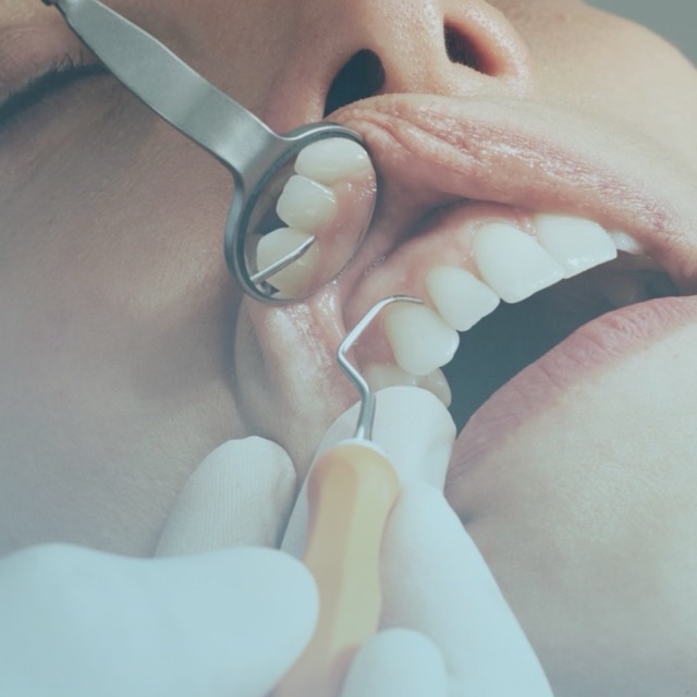 Orta Dental Crowns 1 Home