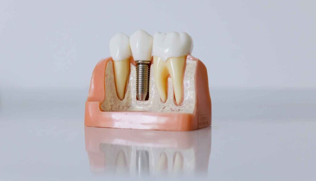 How a Dental Facelift Can Rejuvenate Your Smile 20 dental facelift