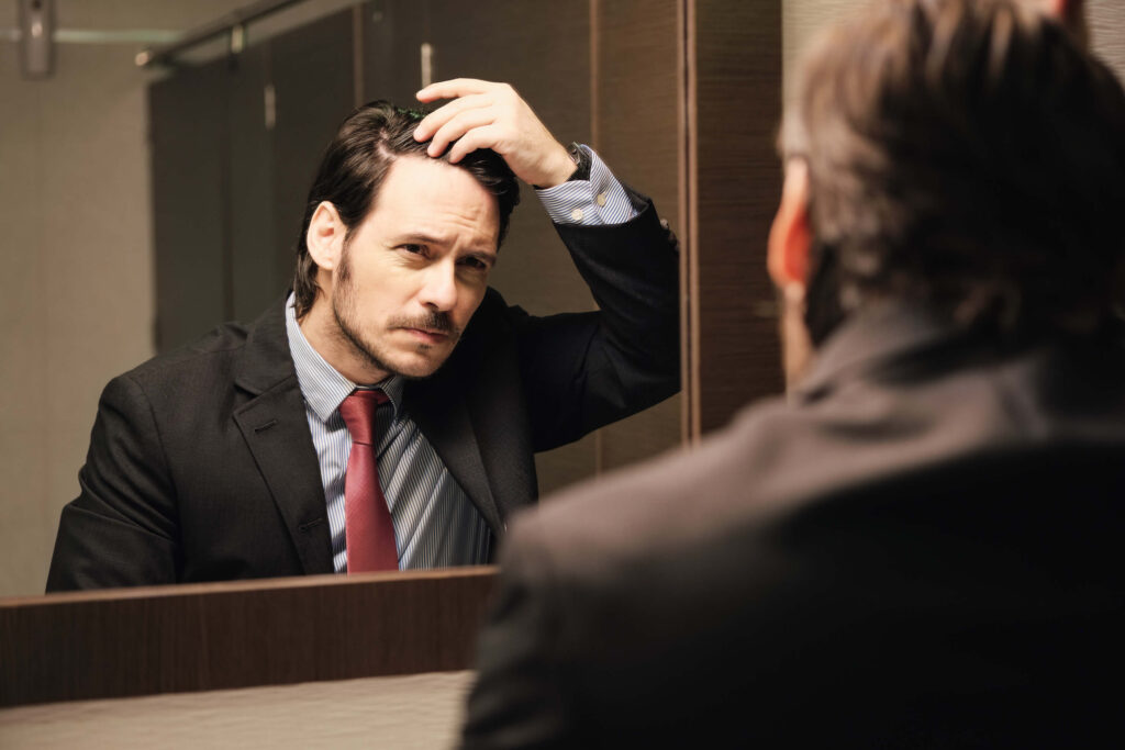 3 Reasons That Made 5000 Graft Hair Transplant Popular 8