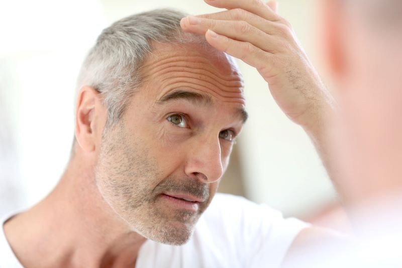 Hair transplant in Turkey